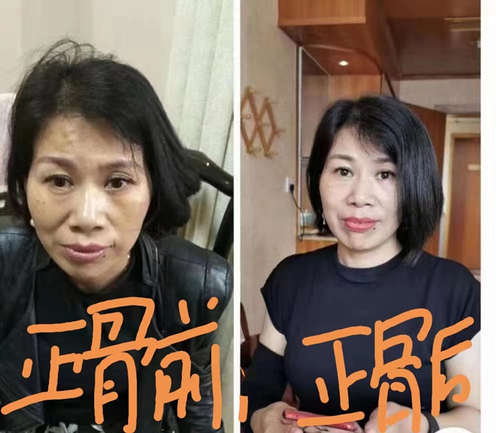 高級(jí)反射蜂療專家范景良 高級(jí)反射蜂療專家范景良